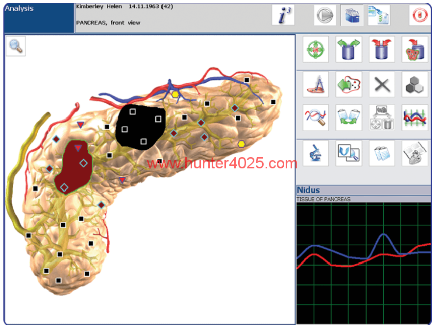 hunter 4025 metatron nls IPP Metapathia GR Hunter 4025 -2