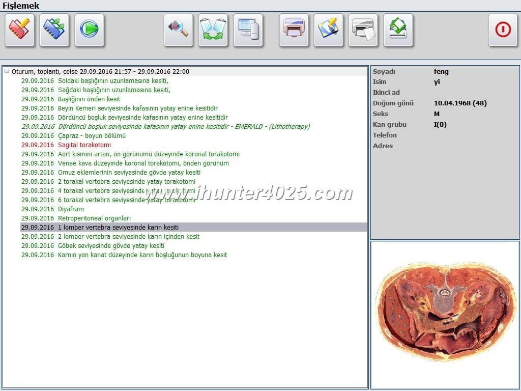 metatron diagnostic machine review