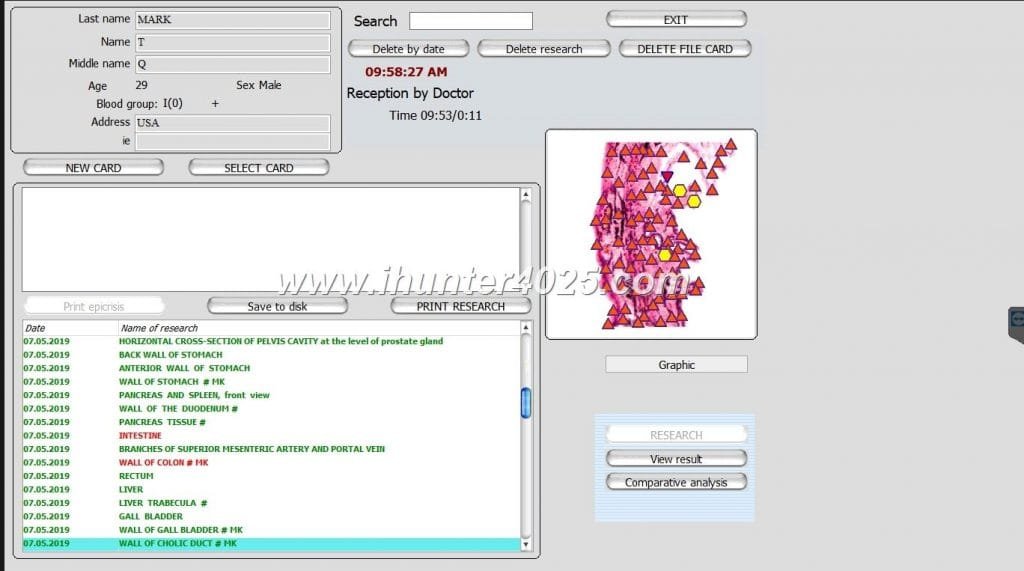 nls diagnostic and analysis