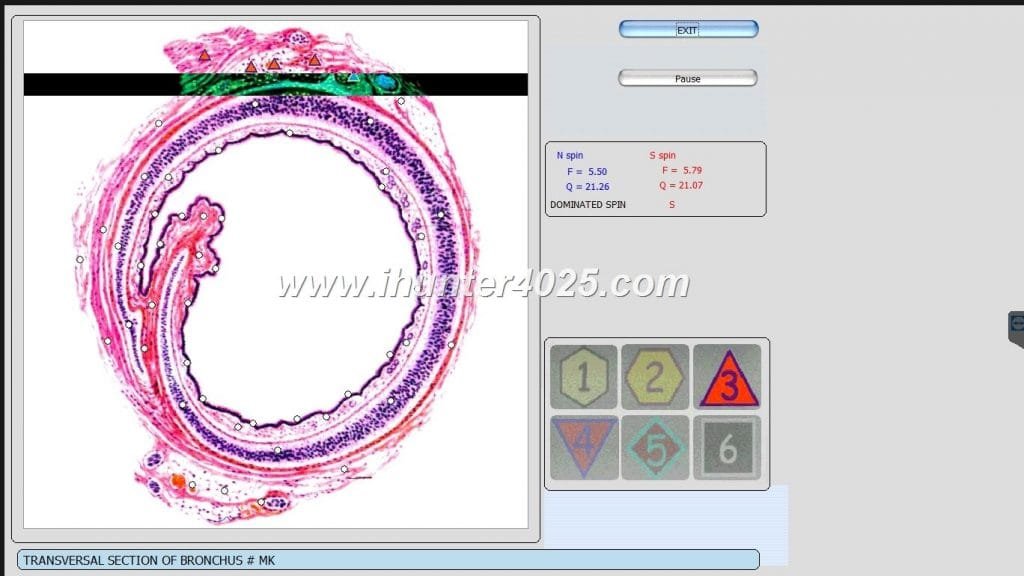 oberon diagnostic system