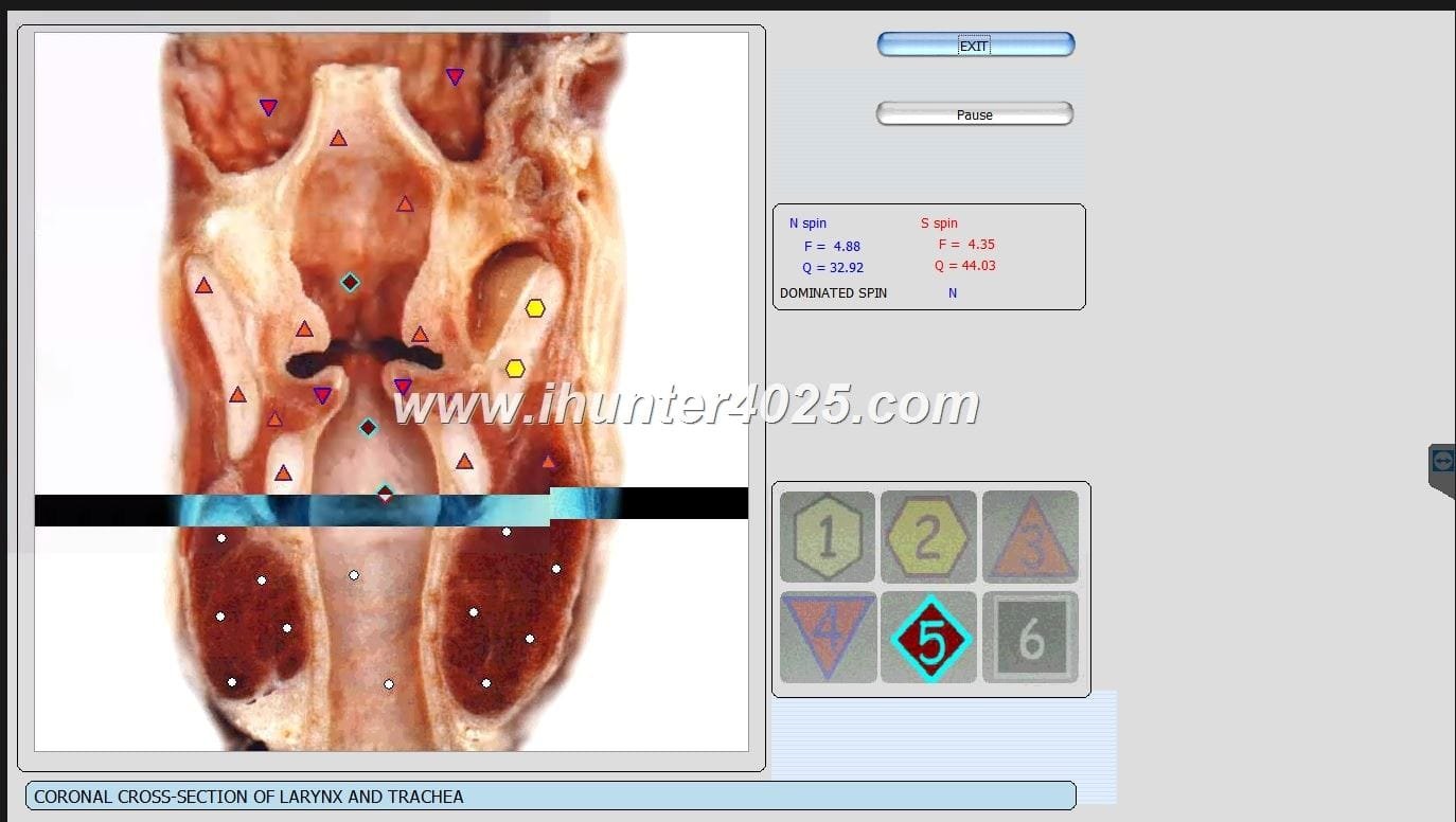 vector nls scan