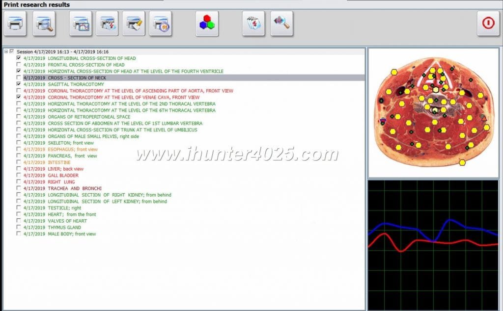 NLS HUNTER
