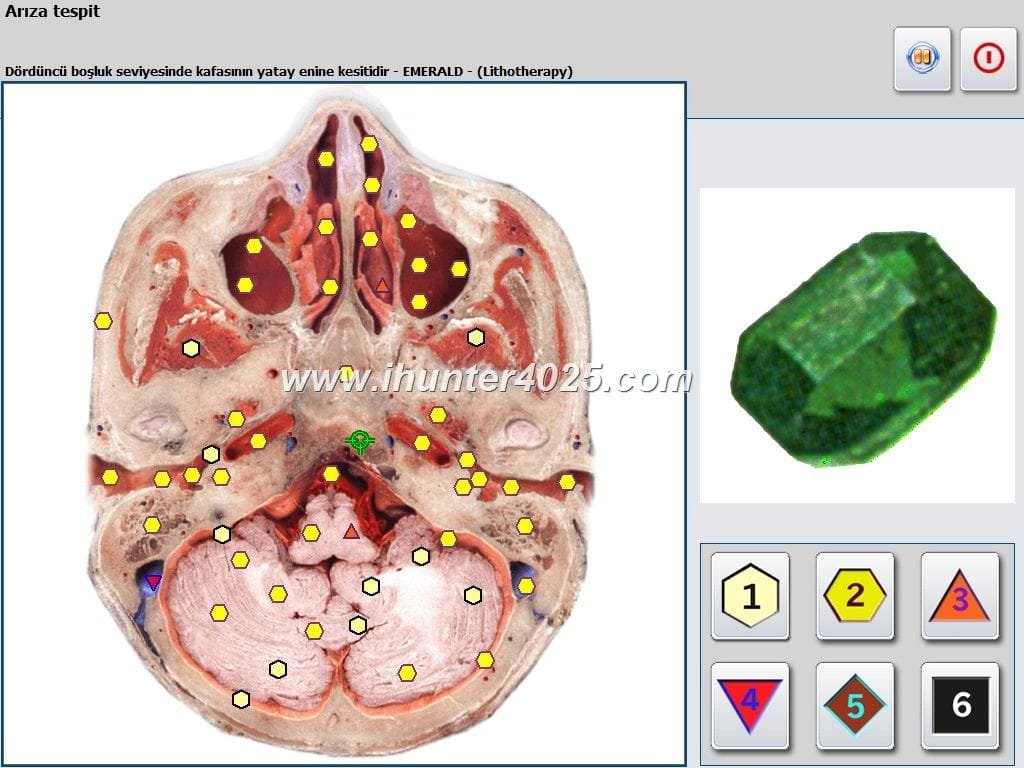 Metatron Bioresonance nls Health Diagnostics
