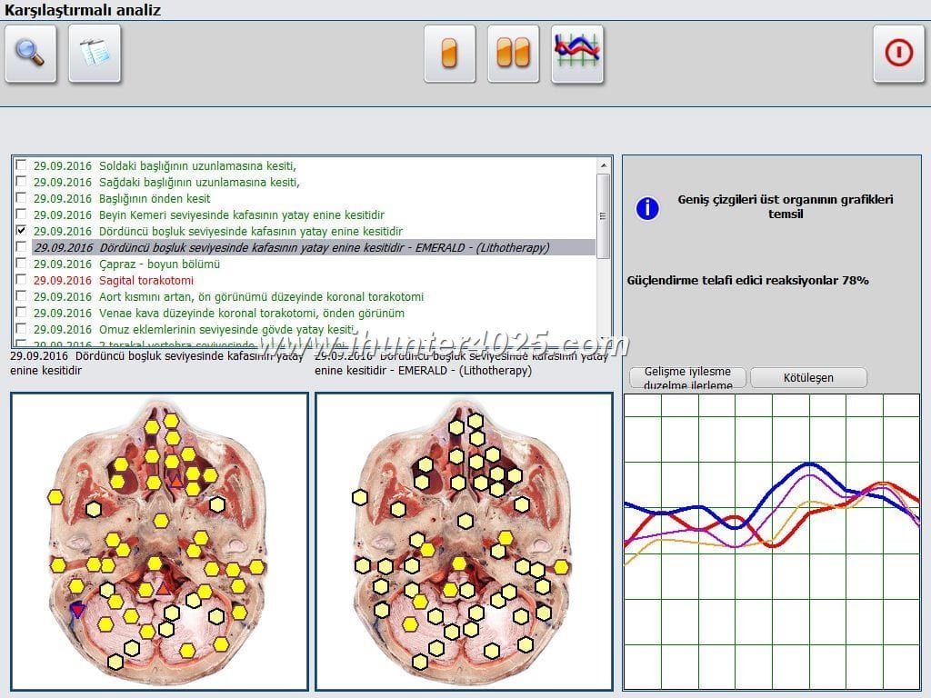 Metatron Bioresonance nls Health Diagnostics