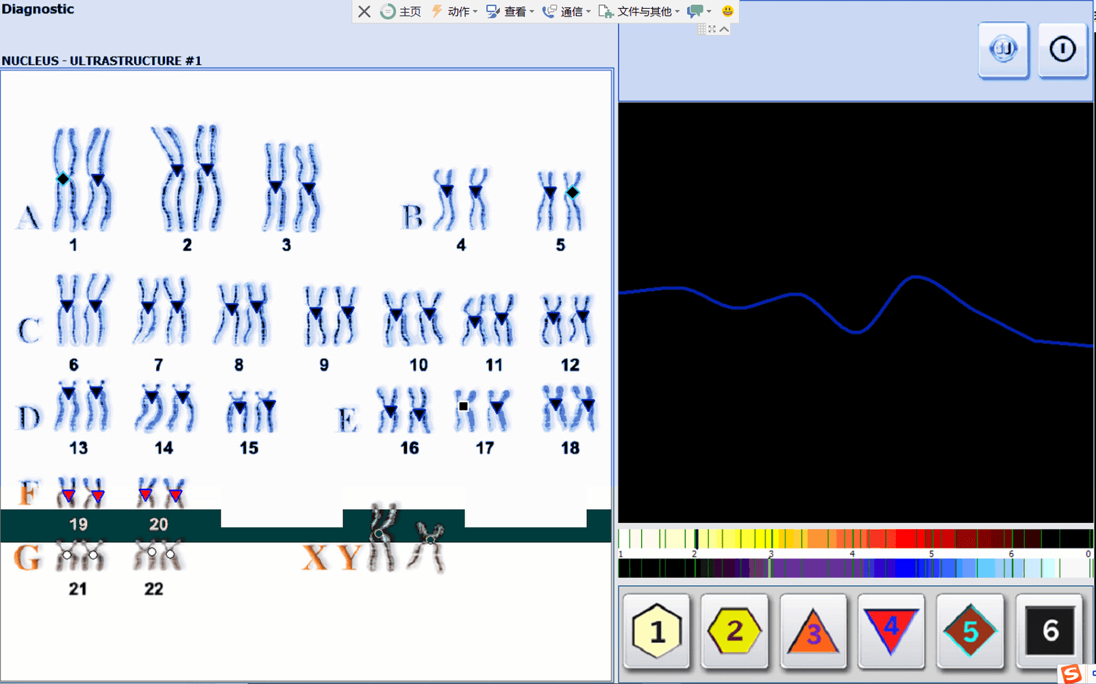 Hunter Metapathia NLS